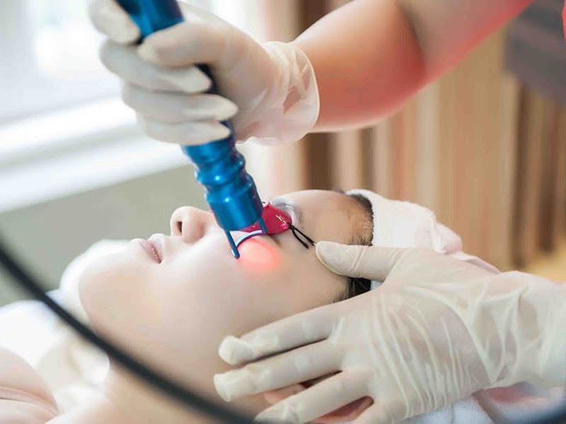 laser co2 fractional trị thâm 5