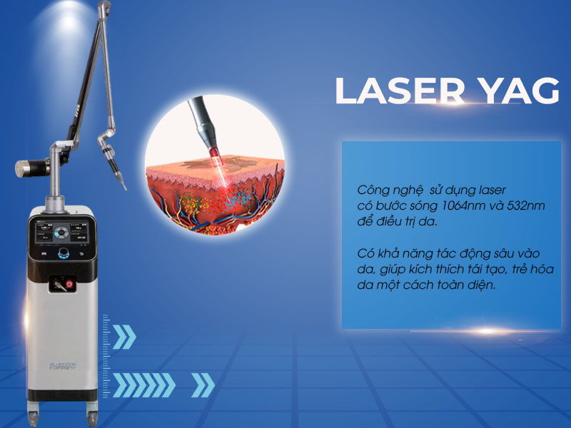 laser yag là gì 1