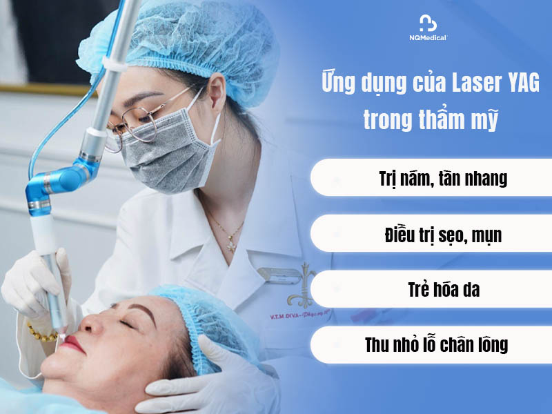 laser yag là gì 4