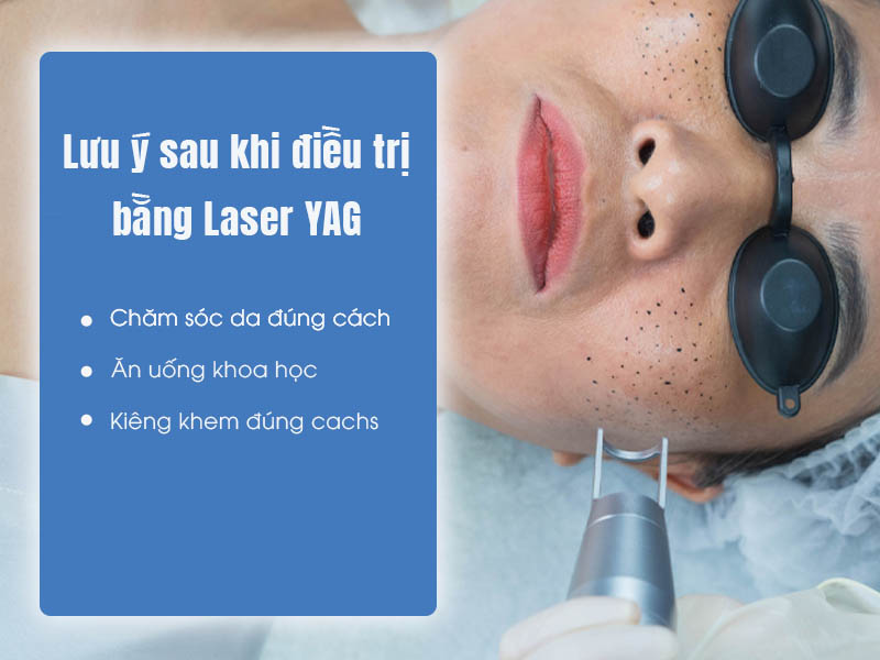 laser yag là gì 9