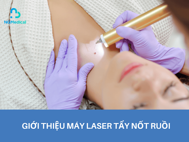Máy Laser tẩy nốt ruồi - 8