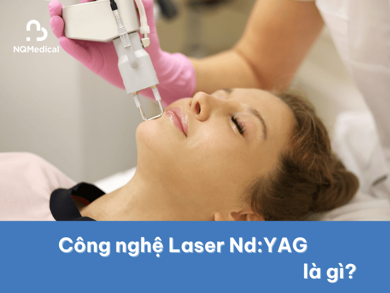 Máy trị nám tàn nhang laser Nd YAG -2