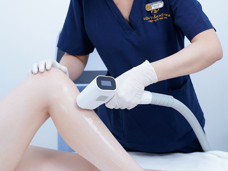 máy triệt lông diode laser 4