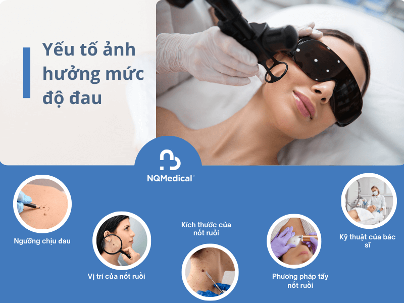 Tẩy nốt ruồi bằng laser có đau không -5