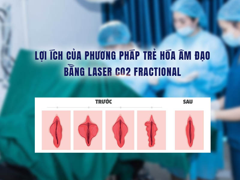 trẻ hóa vùng kín laser co2 fractional 6