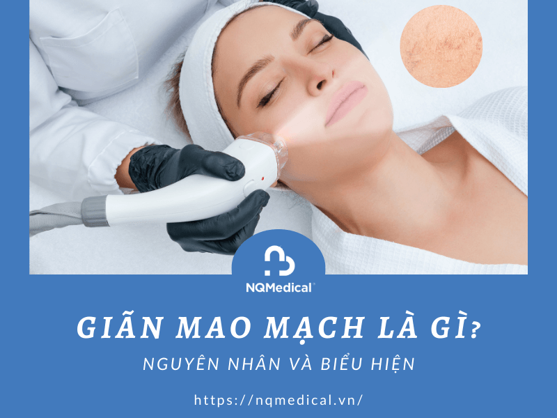 Trị giãn mao mạch bằng Laser Nd YAG -2