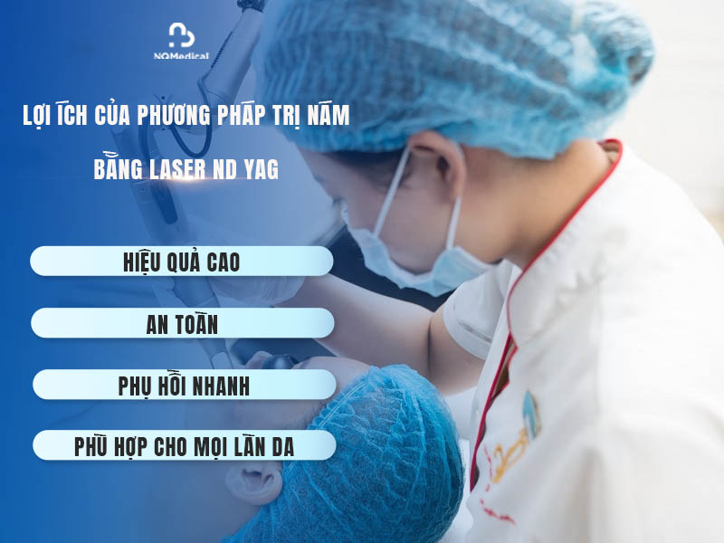 trị nám bằng công nghệ laser nd yag 3