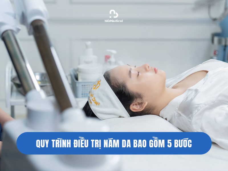 trị nám bằng công nghệ laser nd yag 4