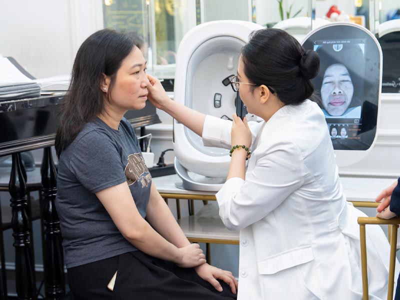 trị nám bằng công nghệ laser nd yag 9
