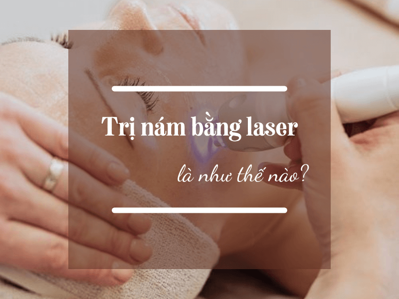 Trị nám bằng laser 15