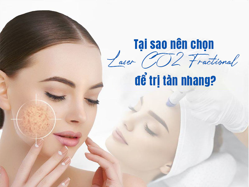 trị tàn nhang bằng laser co2 fractional 3
