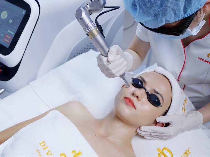 trị tàn nhang bằng laser co2 fractional 4