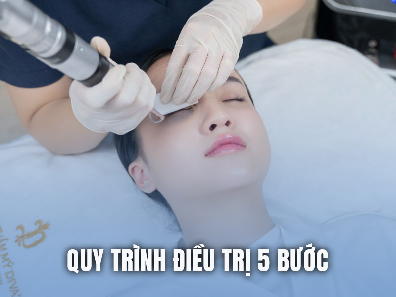 trị tàn nhang bằng laser co2 fractional 5