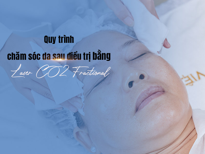 trị tàn nhang bằng laser co2 fractional 7