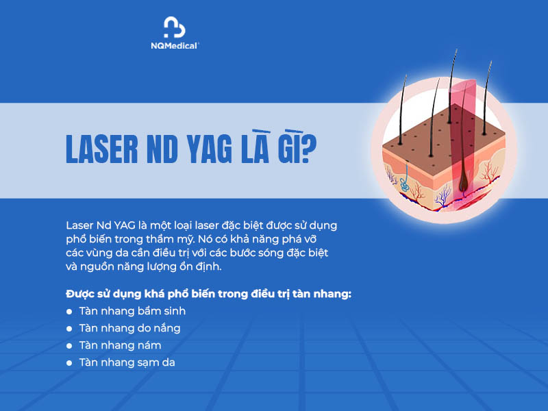 trị tàn nhang bằng laser nd yag 1