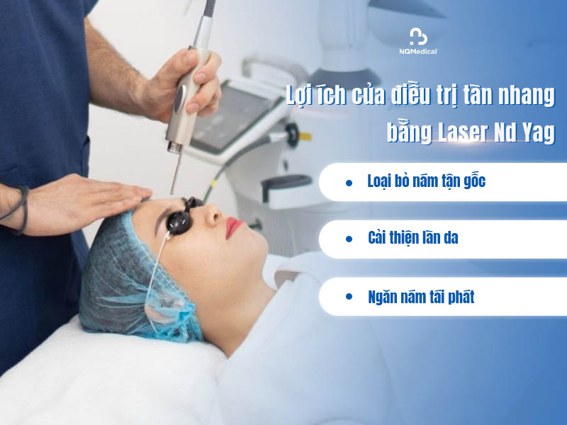 trị tàn nhang bằng laser nd yag 3