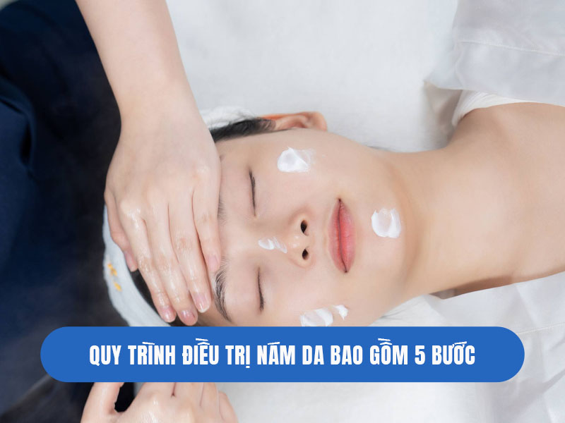 trị tàn nhang bằng laser nd yag 5