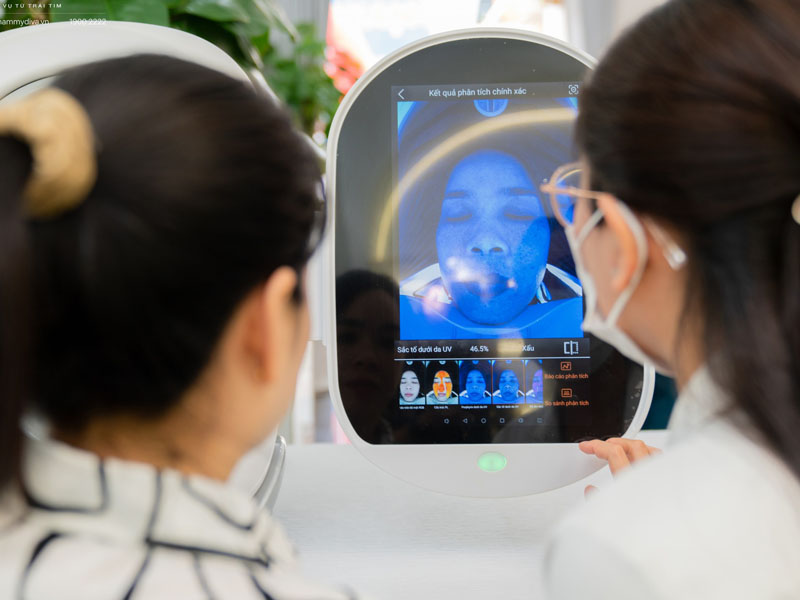 trị tàn nhang bằng laser nd yag 9
