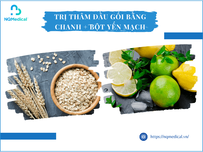 Trị thâm đầu gối bằng chanh - 10