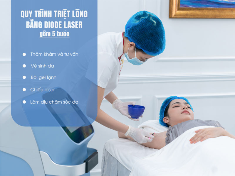 triệt lông bằng diode laser có tốt không 3