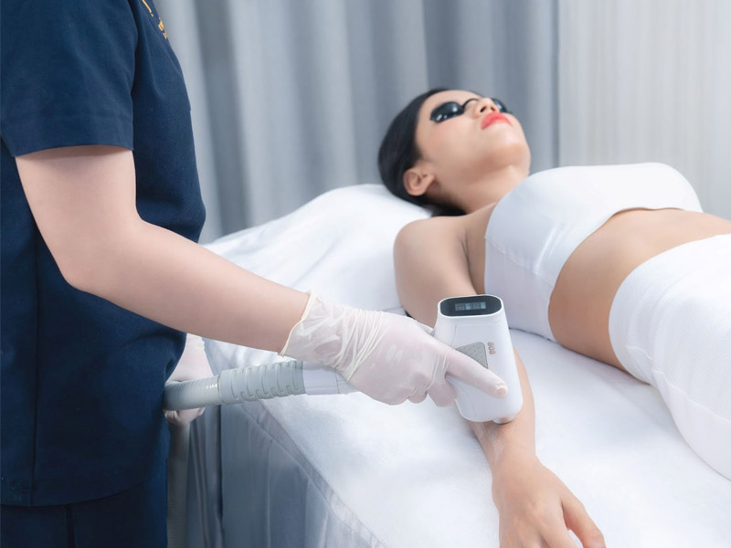 triệt lông bằng diode laser có tốt không 5
