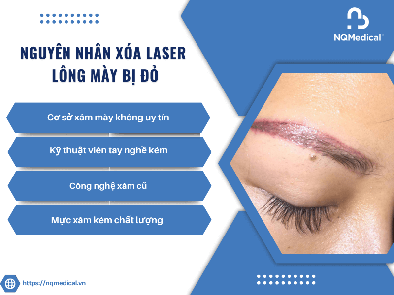 xóa Laser lông mày bị đỏ -5