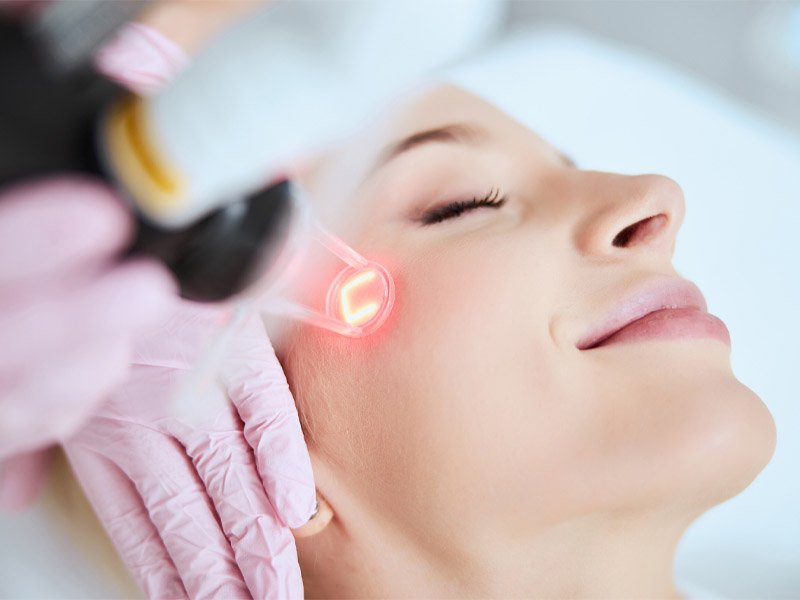 xóa nốt ruồi bằng laser co2 fractional 3