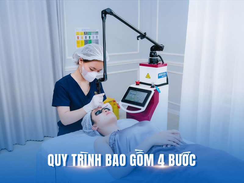 xóa nốt ruồi bằng laser co2 fractional 5