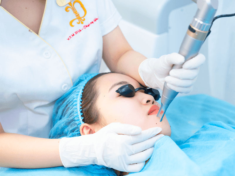xóa nốt ruồi bằng laser co2 fractional 6