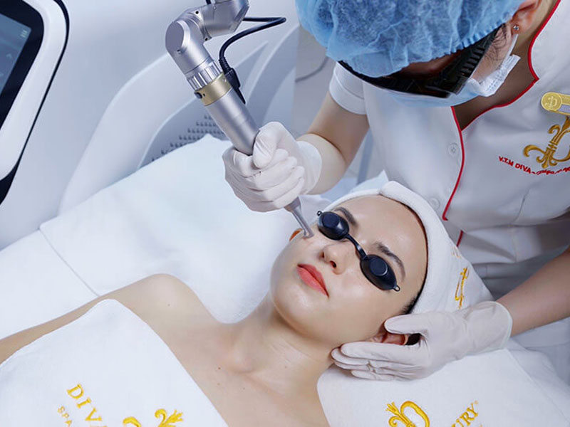 xóa nốt ruồi bằng laser co2 fractional 8