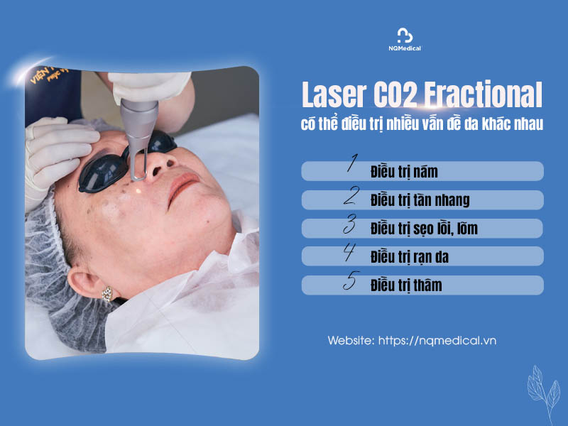 xóa nốt ruồi bằng laser co2 fractional 9