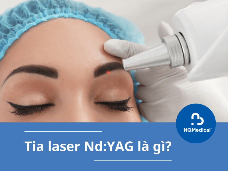 Xóa Xăm Bằng Laser Nd YAG - 2