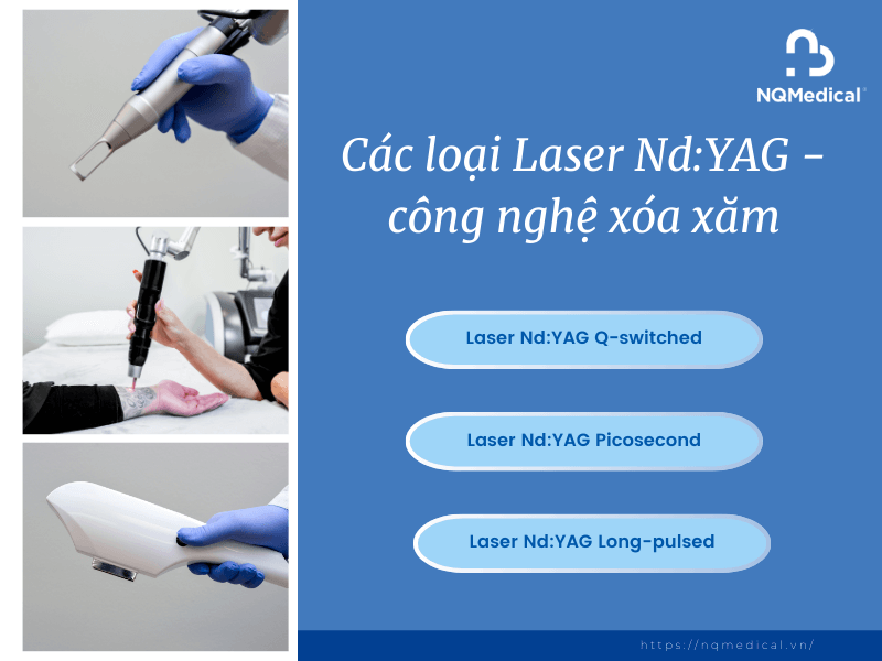 Xóa Xăm Bằng Laser Nd YAG - 4