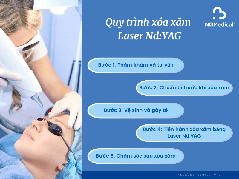 Xóa Xăm Bằng Laser Nd YAG - 5