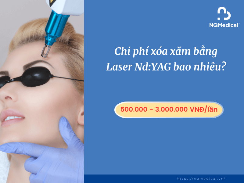 Xóa Xăm Bằng Laser Nd YAG - 6