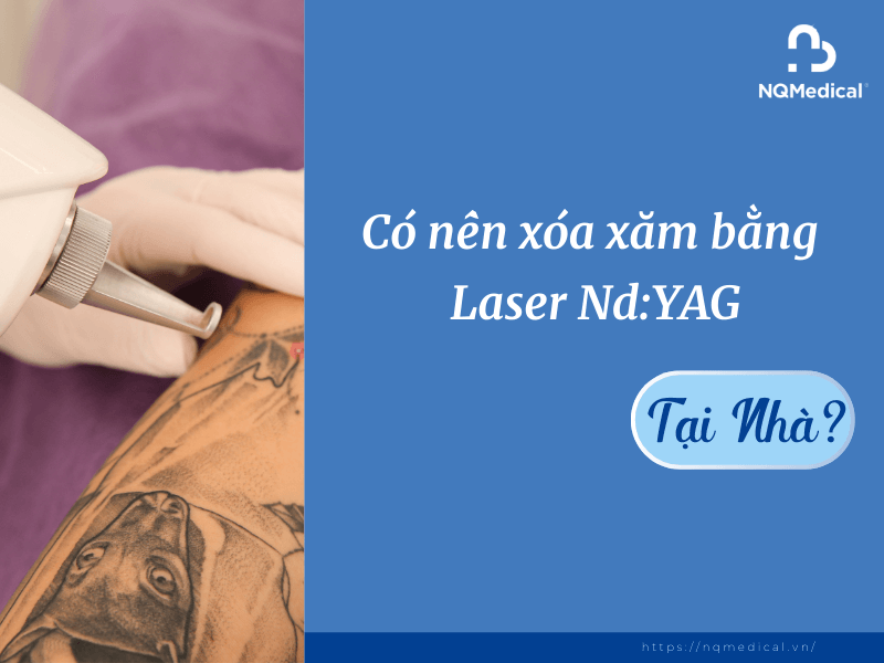 Xóa Xăm Bằng Laser Nd YAG - 7