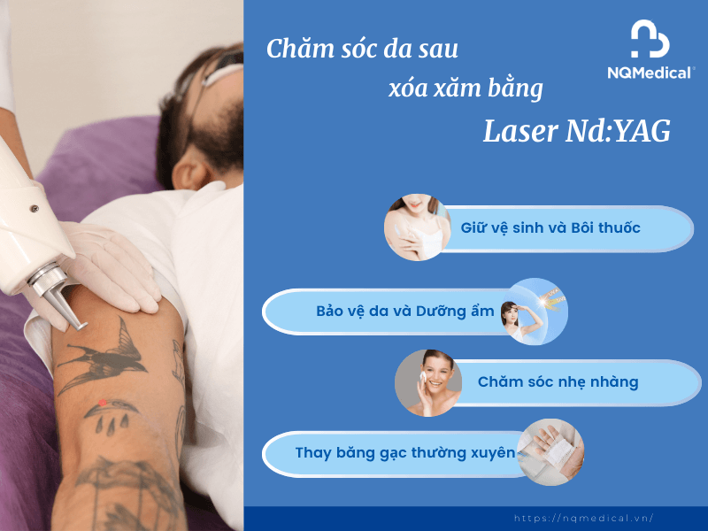 Xóa Xăm Bằng Laser Nd YAG - 8
