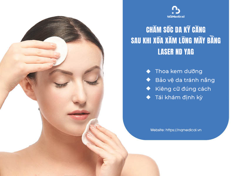 xóa xăm lông mày bằng laser nd yag 5