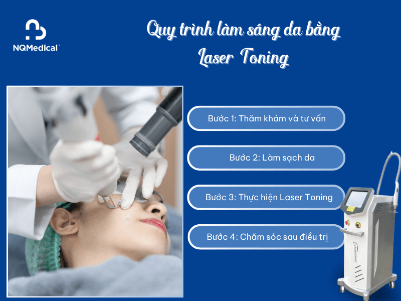 Làm sáng da bằng Laser Toning -4