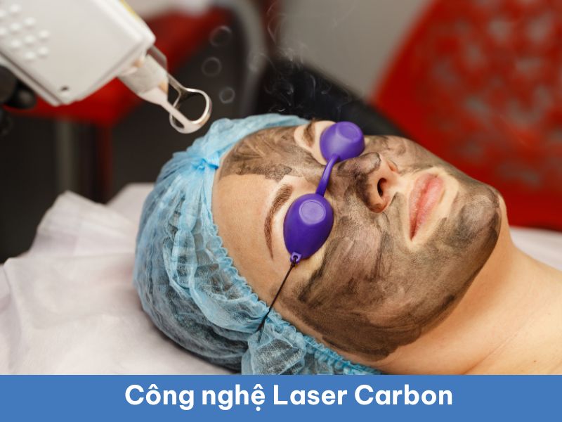 Laser Carbon -2