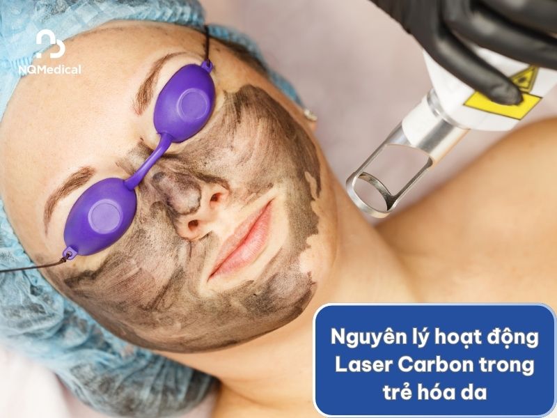 Laser Carbon trẻ hóa da -3