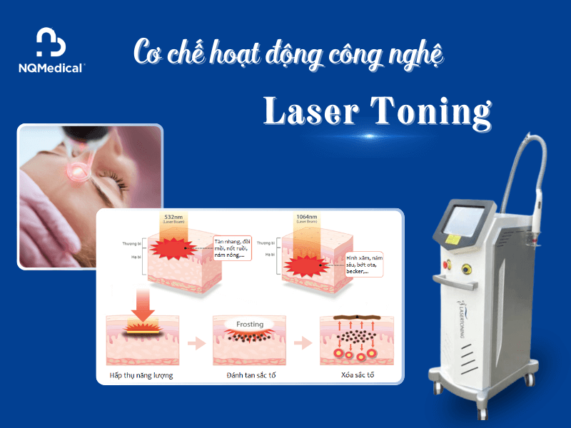 Laser Toning - 3