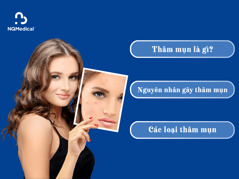 Laser Toning trị thâm mụn - 2