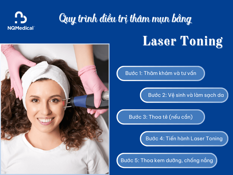 Laser Toning trị thâm mụn - 4