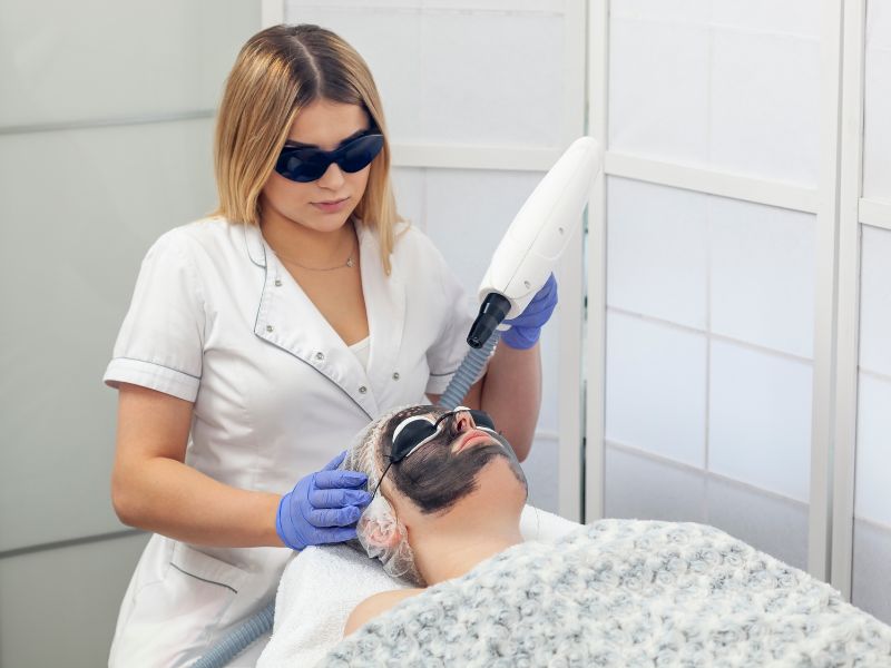 Trị mụn bằng Laser Carbon -10