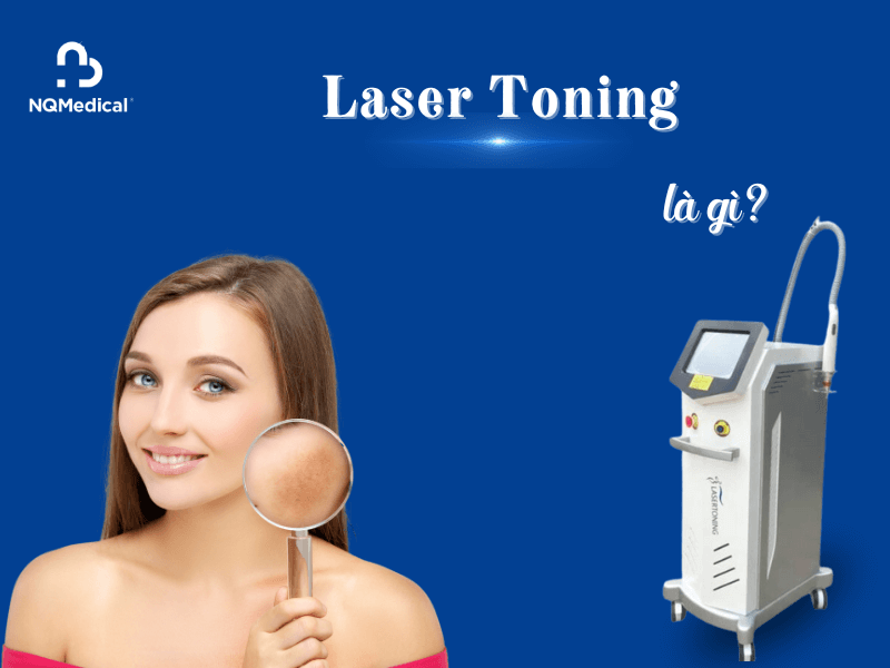 trị nám bằng công nghệ laser toning -2
