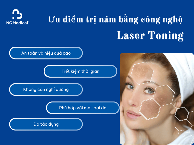 trị nám bằng công nghệ laser toning -3