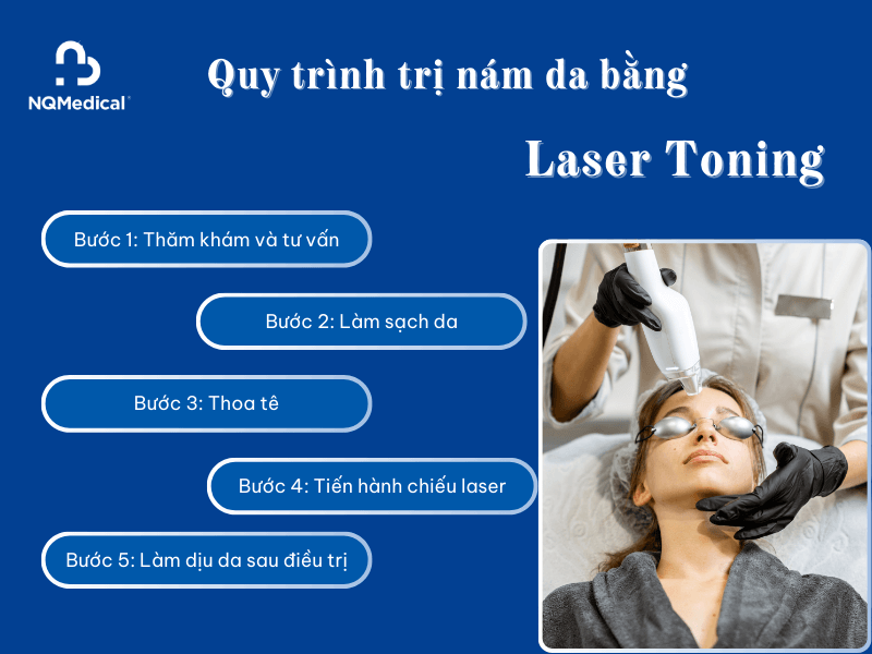 trị nám bằng công nghệ laser toning -5