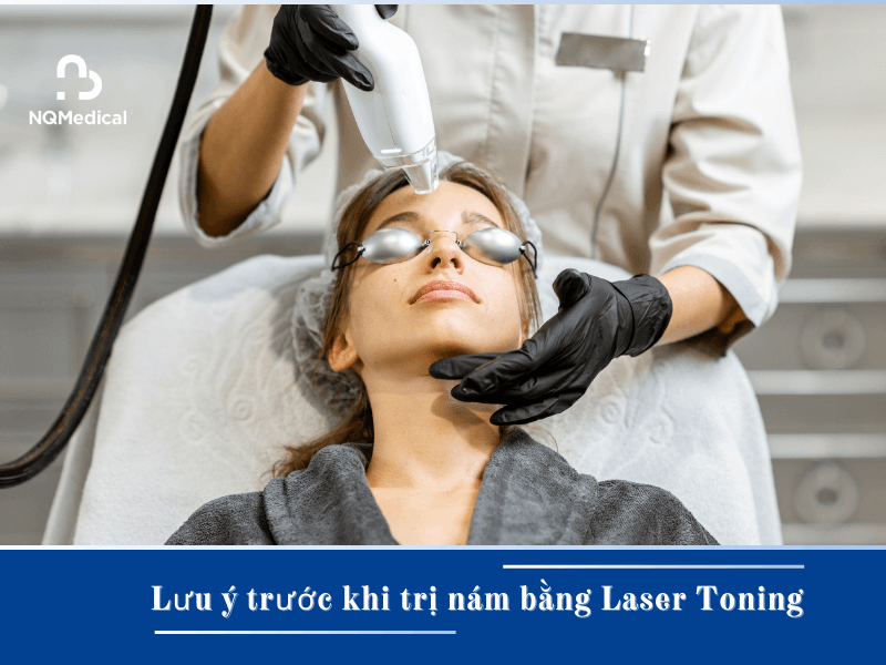 trị nám bằng công nghệ laser toning -7