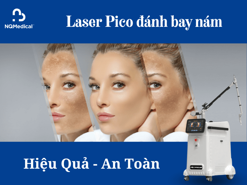 Trị nám bằng Laser Pico - 2